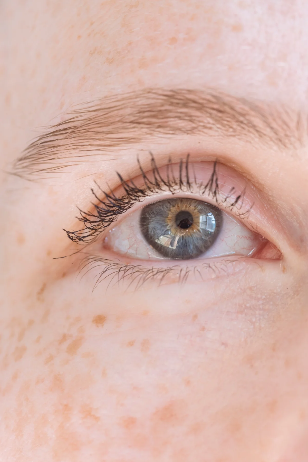 Lightening Treatment